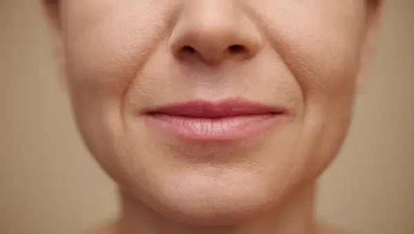 éliminer les rides autour de la bouche